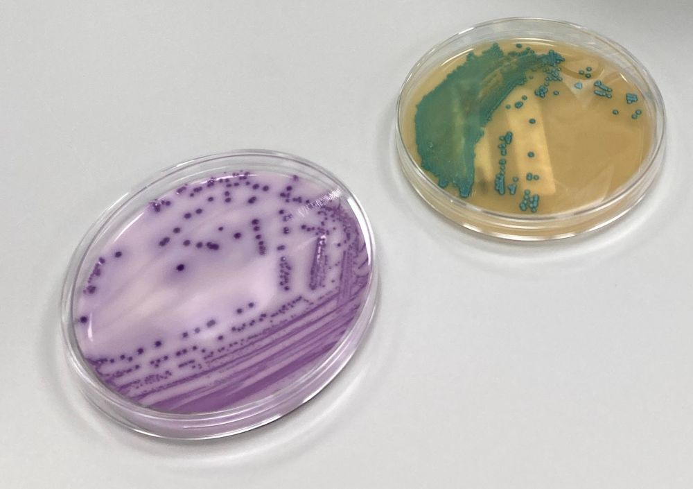 Op het petrischaaltje is salmonella roze en listeria blauw